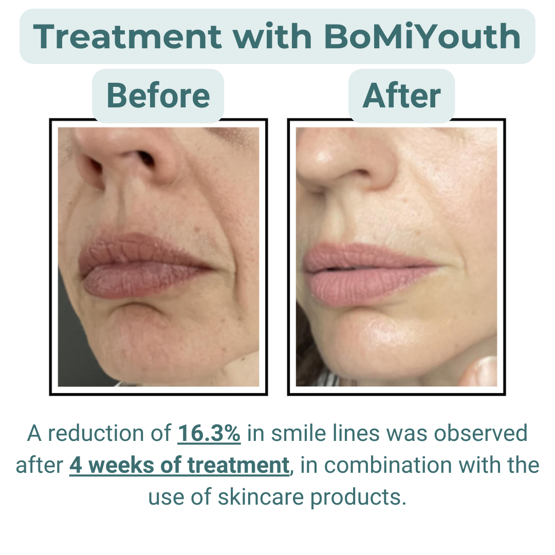 BoMiYouth : Skin Revival par Électromésothérapie